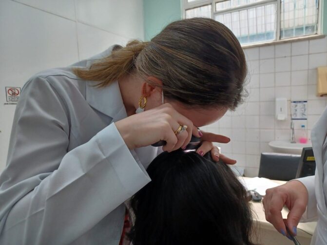 Alopecia: especialista alerta para condição que leva à perda de cabelos e pelos corporais