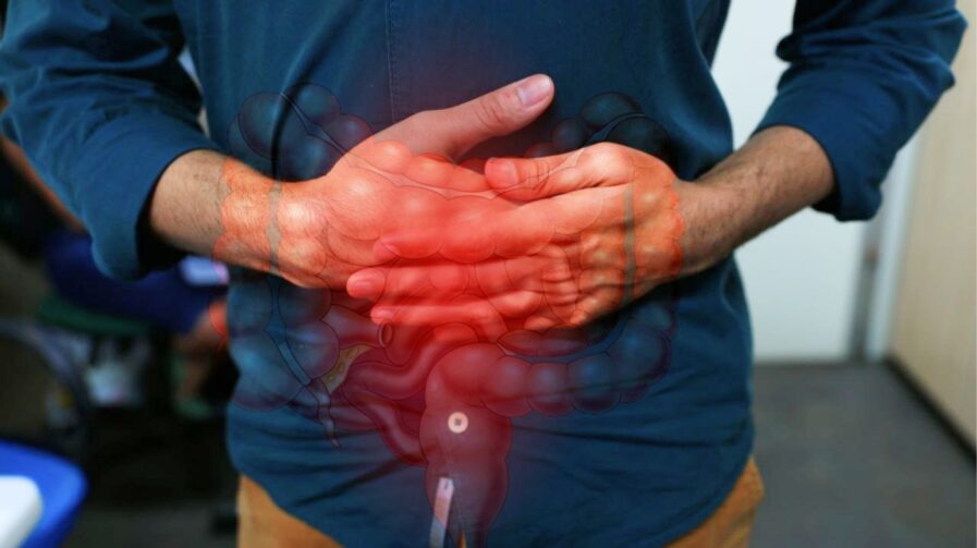 Maio Roxo: gastroenterologista faz alerta para doenças inflamatórias intestinais